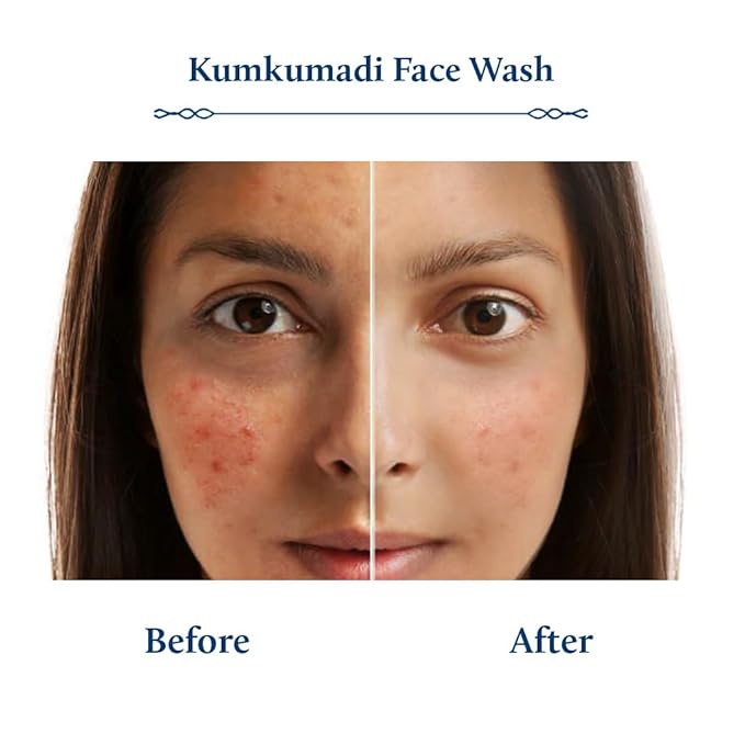 Blue Nectar Kumkumadi Brightening Face Wash with Saffron for Women & Men | Sulphate free Anti Pimple Face Cleanser (10 Herbs, 6.76 Fl Oz)