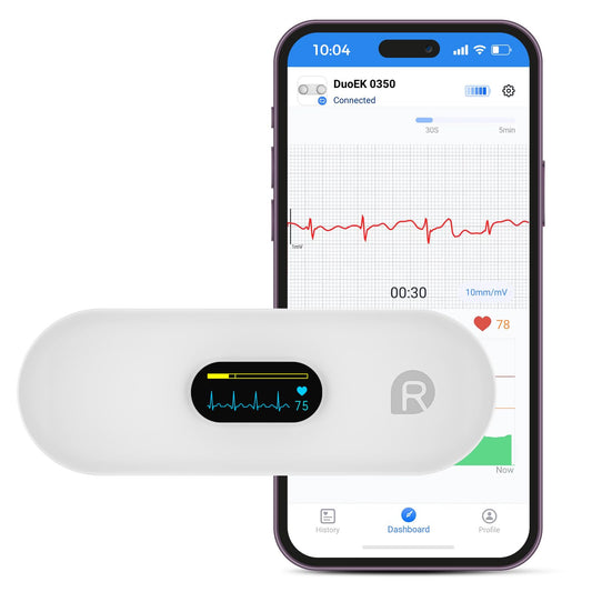 OVIIN Portable Heart Rate Monitor, Wireless Home Use Heart Rhythm Tracker, Heart Monitoring Devices,Smartphone App Compatible with iOS/Android