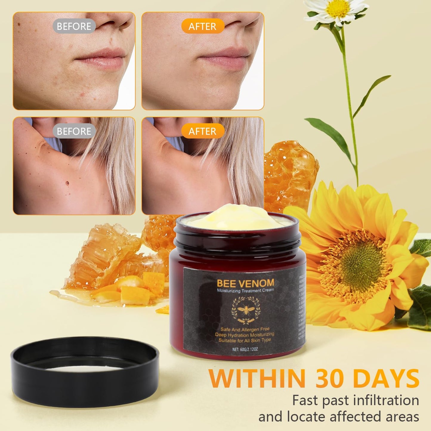 Bee Venom Cream,Bee Venom Comprehensive Cream, Bee Venom Skin Cream,Visibly reduces skin blemishes, Natural Professional Bee Venom Repair Cream, Gently Nourish the Skin, for All Skin Types (2pcs)