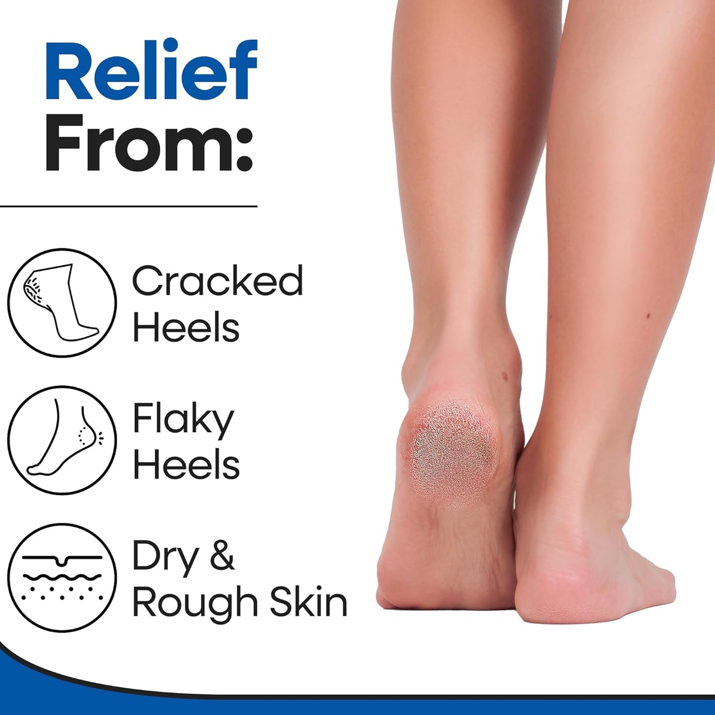 Moisturizing Socks for Mens Cracked Heels - Moisturizer Heel Sleeves to Smooth & Soften Rough Cracked Heels & Dry Feet. Large Aloe Moisturizing Heel Socks (White - 3 Pairs, Fits Most)
