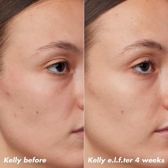 e.l.f. SKIN PLZ Clarify Facial Oil, Face Oil For Treating & Preventing Acne, Helps Calm Redness, Made with Salicylic Acid, Vegan & Cruelty-Free, 1 oz